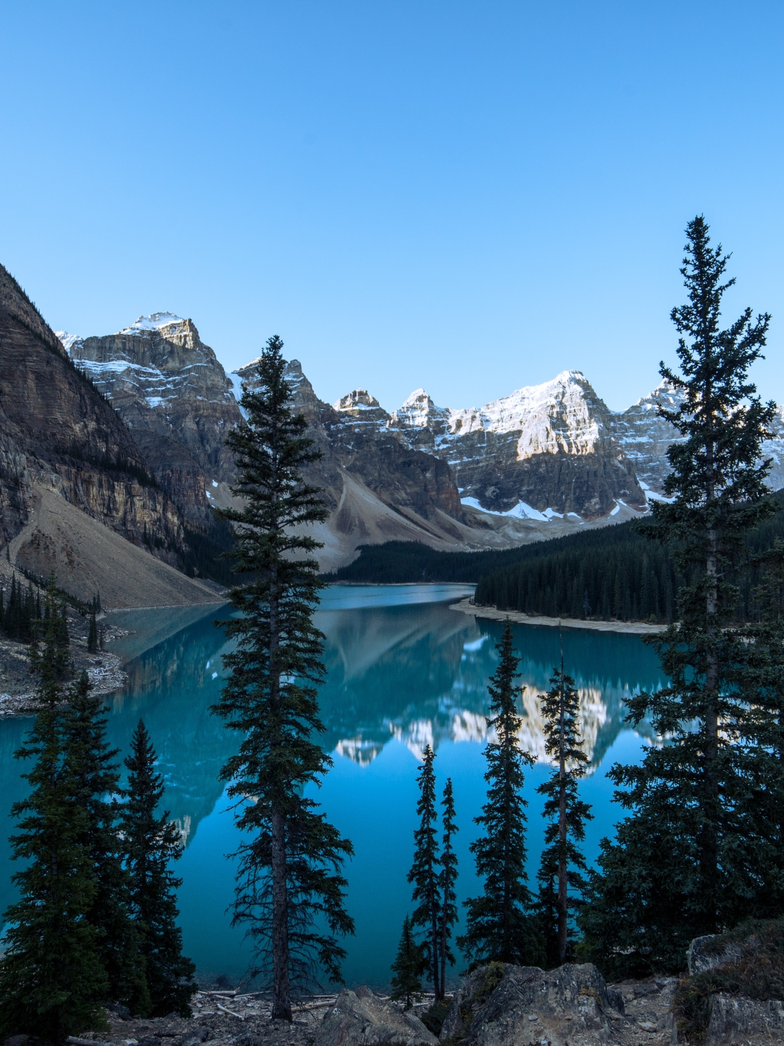 1540x2050 Moraine Lake Wallpaper 4K, Glacier mountains, Canada, Phone