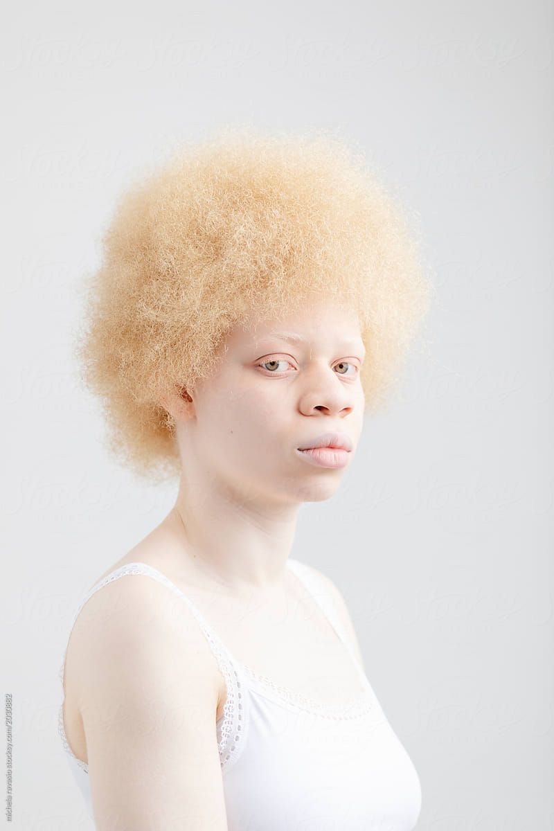 800x1200 Portrait of an albino girl, Phone